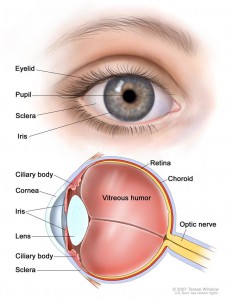 Eye Graphic - Melanoma